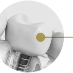 Tips To Choose The Right Dental Implant For Yourself